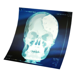 X-Ray Trophy 11 lvl